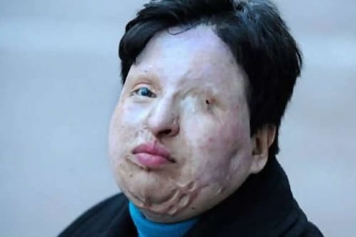 Mulher ganha direito de cegar homem que a atacou