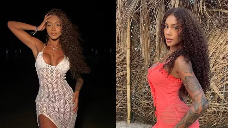 As plásticas de Giovanna Jacobina e sua entrada no BBB 25