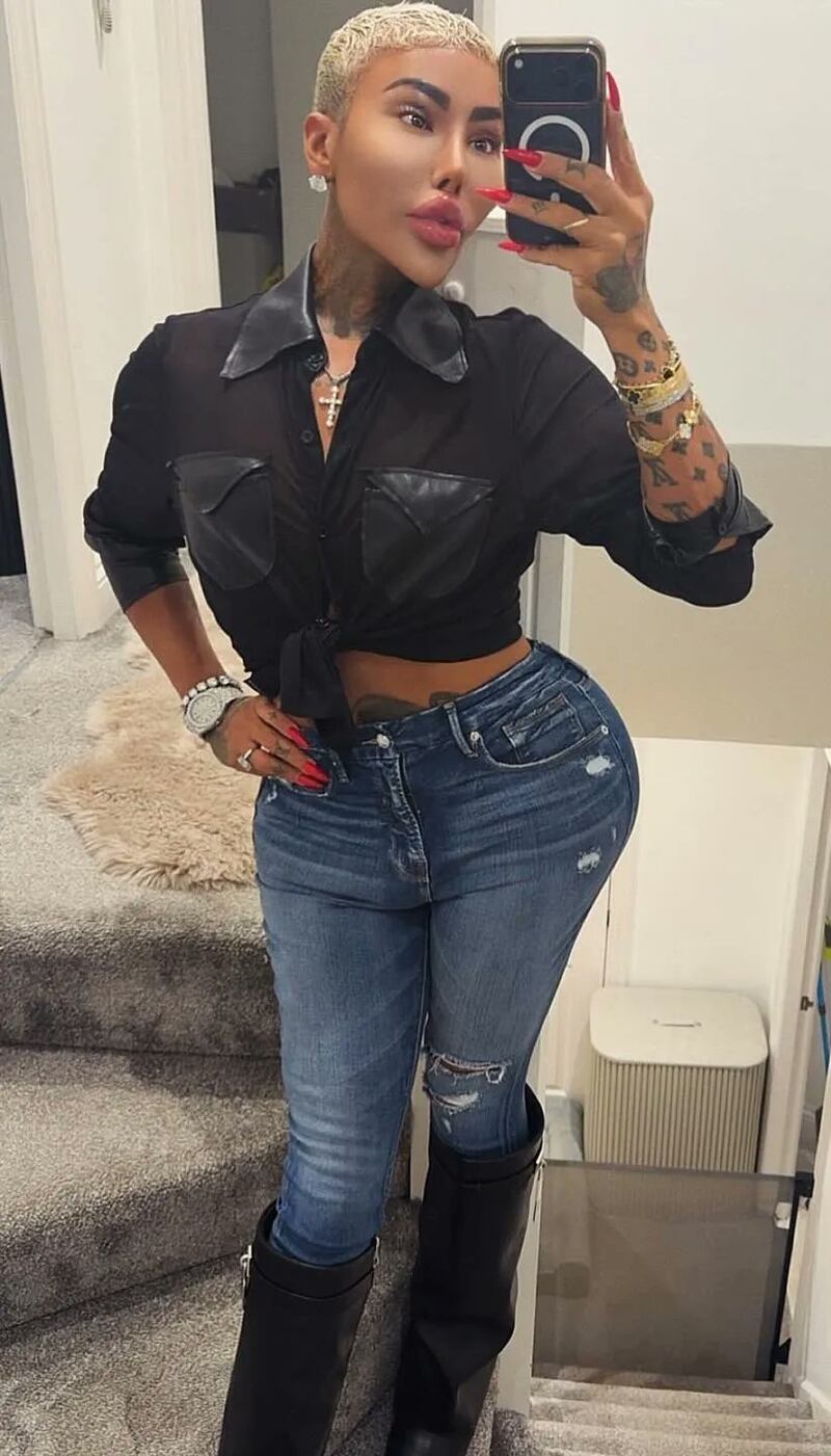 Muere reconocido influencer tras presunta cirugía: el hombre quería verse como Kim Kardashian