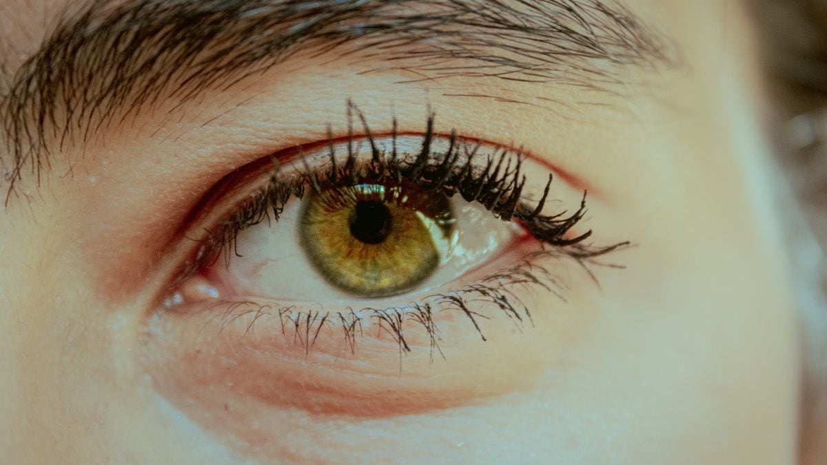 La blefaroplastia es una cirugía estética para lucir una mejor mirada