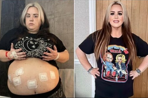 Mulher chegou a pesar 115 quilos após sofrer de depressão: veja como ela conseguiu emagrecer e recuperar seu peso normal